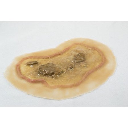 MOULAGE SCIENCE & TRAINING Large Ulcer, Medium w/Odor, PK 12 MST-45-03-O12